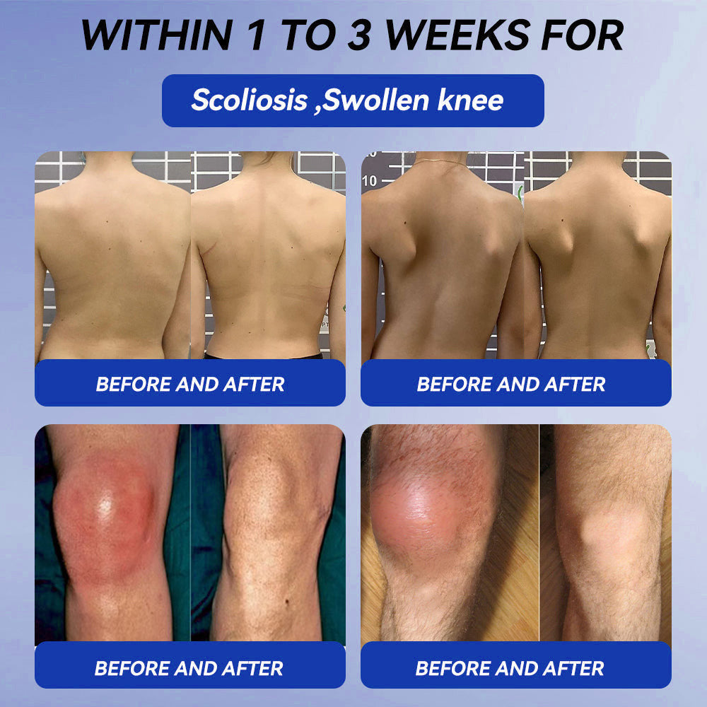 𝒁𝐯𝐨𝐞𝐯𝐨® BPC-157 + TB-500 Rapid-Release Oral Patch 🦴 Fast-Acting Pain Relief for Arthritis, Nerves & Sports Injuries