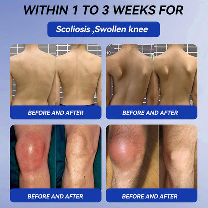 𝒁𝐯𝐨𝐞𝐯𝐨® BPC-157 + TB-500 Rapid-Release Oral Patch 🦴 Fast-Acting Pain Relief for Arthritis, Nerves & Sports Injuries