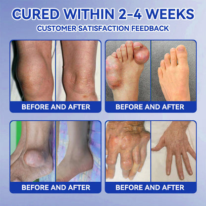 𝒁𝐯𝐨𝐞𝐯𝐨® BPC-157 + TB-500 Rapid-Release Oral Patch 🦴 Fast-Acting Pain Relief for Arthritis, Nerves & Sports Injuries